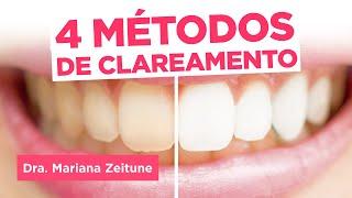 Conheça os 4 métodos de CLAREAMENTO DENTAL - Dra. Mariana Zeitune