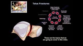 Talus Fractures - Everything You Need To Know - Dr. Nabil Ebraheim