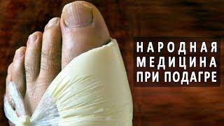 Народная медицина в лечении подагры