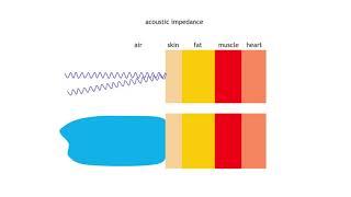 Ultrasound Physics | British Society of Echocardiography Theory Exam Revision