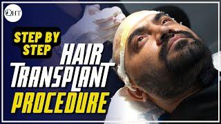 Step by Step QHT Hair Transplant Surgery in India |FULL PROCEDURE | QHT Clinic by Regrow, Haridwar