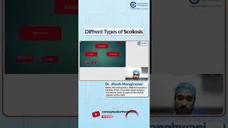 Different Types of Scoliosis Dr. Jitesh Manghwani | Conceptual Orthopedic | Orthopedic Residency