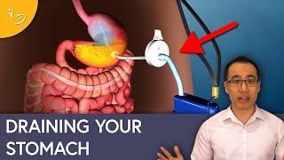 Medical Devices for Weight Loss: The Good, the Bad, and the Ugly