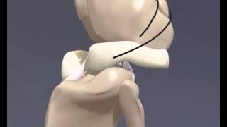 Cranial Cruciate Ligament Rupture - 3D Animation for Veterinary Undergraduates