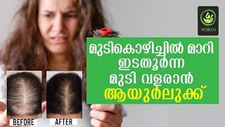 ഒരു നല്ല Ayurvedic Hair Oil നോക്കുന്നുണ്ടോ?|Ayurluq Hair Oil Review|Hair Oil|Ayurluq Shampoo