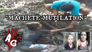 MACHETE MUTILATION | CASO REAL