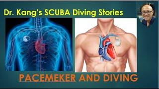 Dr. Kang's SCUBA diving stories - Can someone with pacemaker enjoy SCUBA Diving?