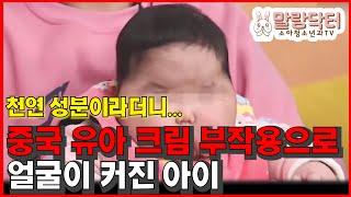 소아청소년과 의사가 본 중국 저질 아기크림 부작용 (스테로이드 부작용)