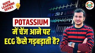Potassium Mein Changes Aane Par ECG Kaise Gadbad Hoti Hai? Quick Learning Series by Siddharth Sir