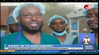 Mandera County medics carry out a lithopedion surgery