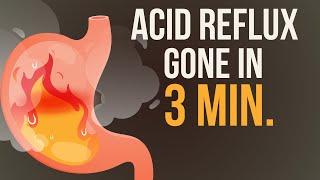 Reduce your Acid Reflux / Heartburn in just 3 Minutes! 