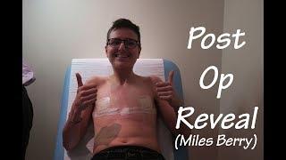 FTM Top Surgery Reveal - Miles Berry (Private, London)