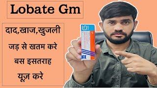 Lobate gm cream use review in hindi|| lobate gm cream benefits in hindi||lobate gm cream