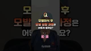 모발이식 후, 모발 성장 과정은 어떻게 될까요? l 김경복원장 l 모먼트의원 MOMENT l 히든컷