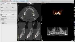 2D and 3D Interactive Data Visualization using Python | Enthought Software Development