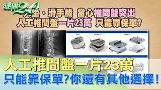 人工椎間盤一片23萬 只能靠保單？ 你還有其他選擇！ 健康2.0