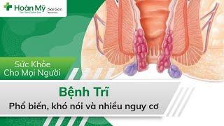 Bệnh trĩ | Trĩ là bệnh gì? Dấu hiệu, Nguyên nhân, Biến chứng và Ăn uống