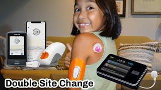 Dexcom G6 & Tandem Tslim x2 Insertion | Type One Diabetes |