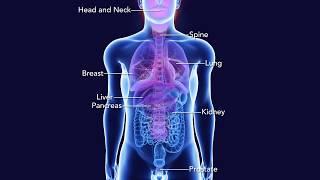 Radixact Treating Prostate Tumors with Synchrony