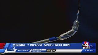 Minimally invasive surgery for sinus problems brings relief