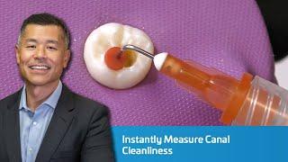 Instantly Measure Canal Cleanliness | Game-Changer for Endo | Dentist 2 Dentist