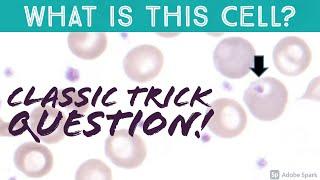 Classic Exam Trick Question: What's This? Hint: It's NOT Malaria, Pappenheimer, or Howell-Jolly
