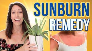 2 Powerful Natural Remedies For Sunburns | FAST Sunburn Relief for Pain & Reduces Peeling