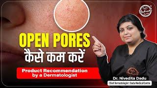 Open Pores क्या होते हैं? | Open Pores कैसे ठीक करे? | Open Pores Product | Dadu Medical Centre