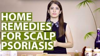 Scalp Psoriasis Treatment At Home | Natural Remedies