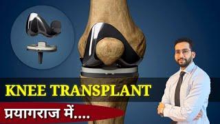 KNEE REPLACEMENT IN PRAYAGRAJ |KNEE TRANSPLANT HOW DO WE DO IT