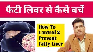 Fatty Liver बीमारी से बचने का उपाय | फैटी लीवर Control kaise Karen | Dr Santosh Singh