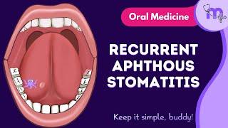 Recurrent Aphthous Stomatitis | Full Video | Oral Medicine | Medi Study Go