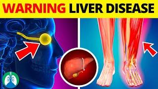 Top 10 Early Warning Signs of Liver Disease to NEVER IGNORE