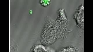 Phagocytosis of MRSA by a human neutrophil
