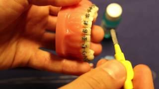 Orthodontist London for Adults and Children Instructions