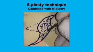 Overview of 12 Plastic Surgery Reconstruction Techniques in Head and Neck