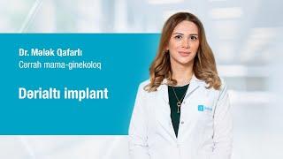 Cərrah mama-ginekoloq Dr.Mələk Qafarlı -  Dərialtı implant