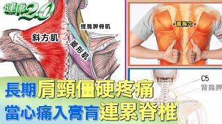 長期肩頸僵硬疼痛 當心痛入膏肓連累脊椎 健康2.0