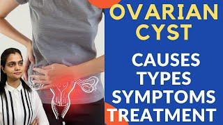 Ovarian Cyst क्या होती है | Ovary में गाँठ के कारण, लक्षण और इलाज in Hindi - Dr. Mayuri Kothiwala.