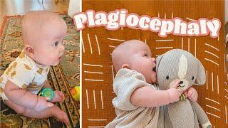 MY BABY HAS SEVERE PLAGIOCEPHALY | How We Found Out + Next Steps