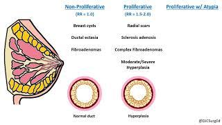 Breast Disease -- Risk Lesions (Pt. 1)