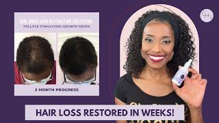 From Hair Loss to Hair Growth in Weeks!