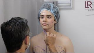 Facial Contouring and Skin Tightening on a Young Patient with Renuvion