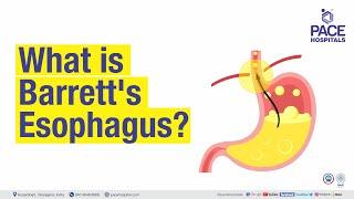 What is Barrett's Esophagus?  | PACE Hospitals #Shortvideo