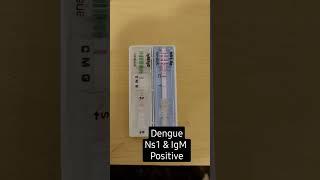 Dengue Ns1 & IgM Positive 