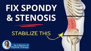 Fix Spondylosis & Stenosis with Core Engagement