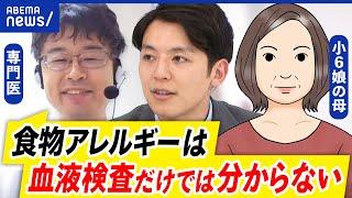 【食物アレルギー】生徒のおやつ交換禁止ってアリ？なぜ理解が進まない？潔癖主義が影響？当事者の母と議論｜アベプラ