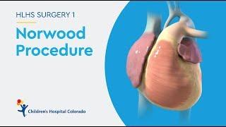 What is the Norwood Procedure for Hypoplastic Left Heart Syndrome