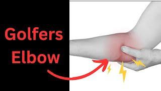 How To Fix Golfers Elbow - 2 Exercises