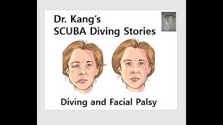 Dr. Kang's SCUBA Diving Stories - Diving and facial palsy